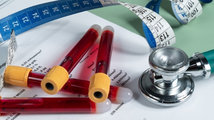 analisis de sangre