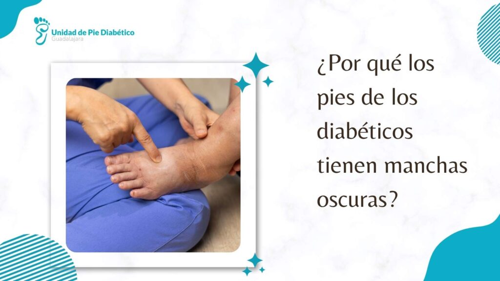 pie diabético manchas