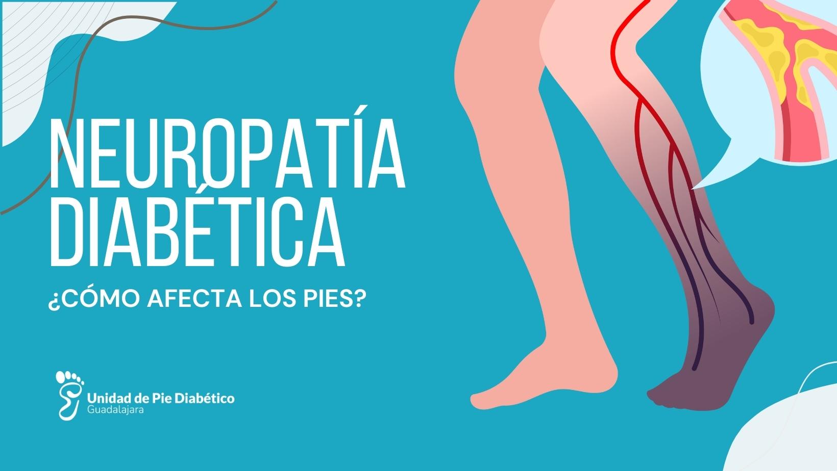 neuropatia diabetica