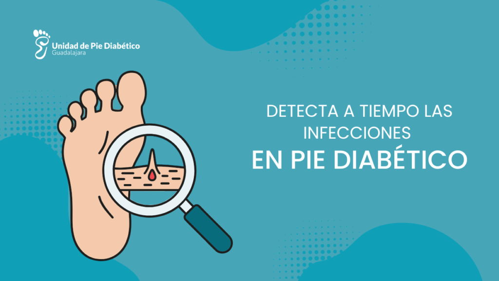 infecciones en el pie diabético