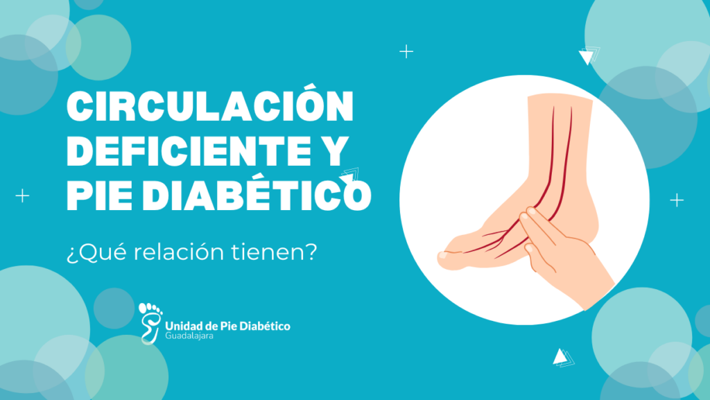 circulación deficiente