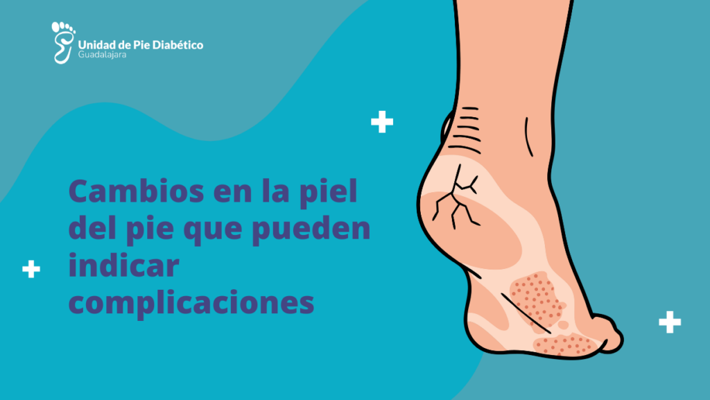 piel del pie